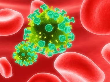 new_hiv_strain_found_in_russia