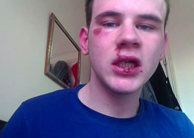 homophobic_attack_student_actually_fell_on_face